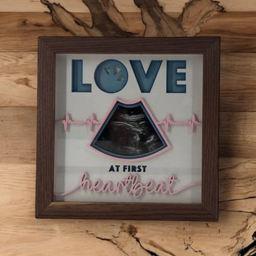 Ultrasound Shadowbox Picture Frame| Mom gift| Baby Shower gift| Handmade for expecting parents| Baby announcement| It's a boy| It's a girl