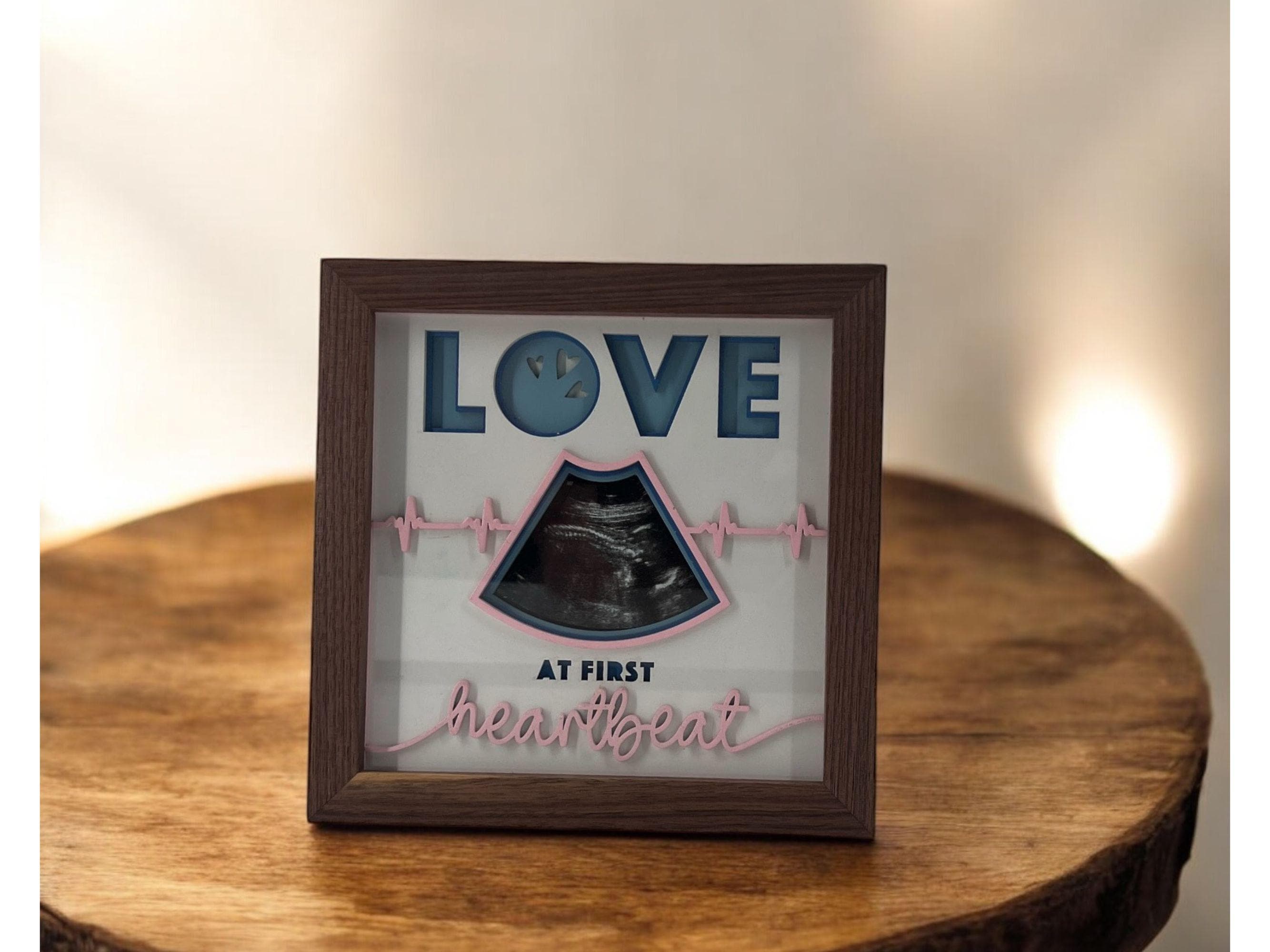 Personalized Ultrasound Shadowbox Picture Frame