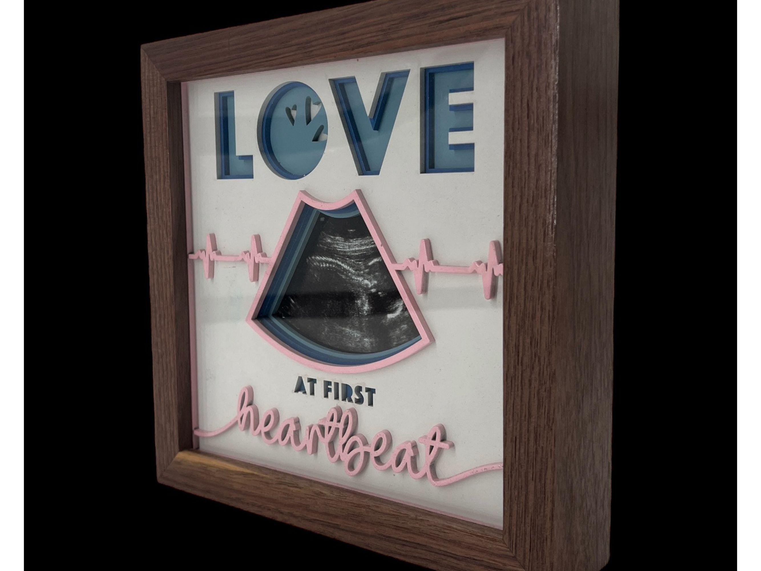 Personalized Ultrasound Shadowbox Picture Frame