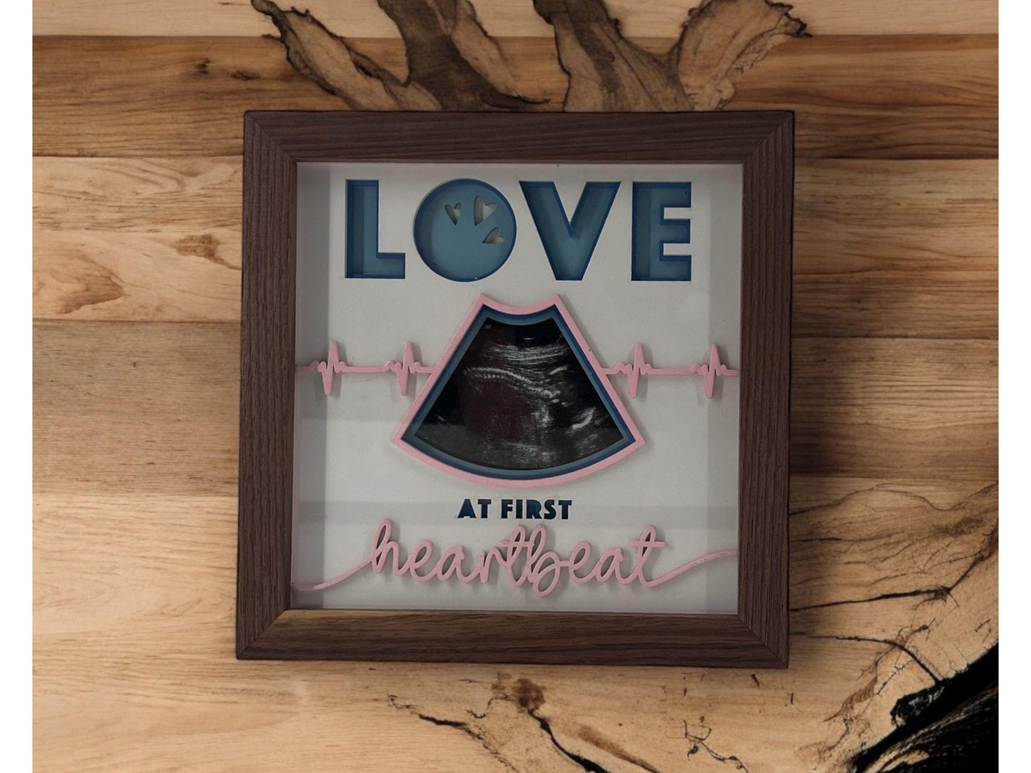 Ultrasound Shadowbox Picture Frame| Mom gift| Baby Shower gift| Handmade for expecting parents| Baby announcement| It's a boy| It's a girl